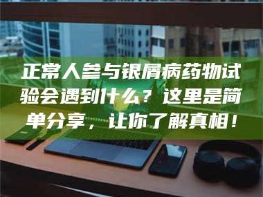 乳山正常人参与银屑病药物试验会遇到什么？这里是简单分享，让你了解真相！